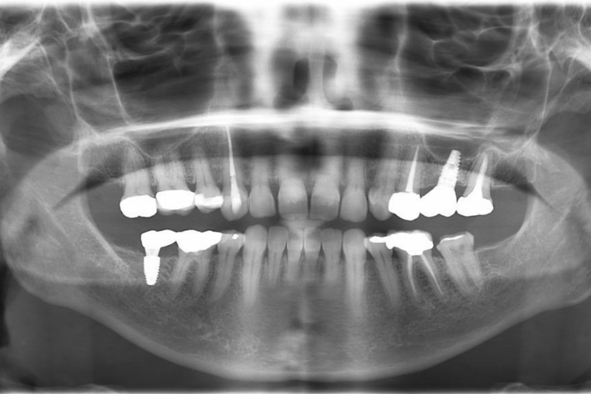 Paquete ortodoncia (referencial)