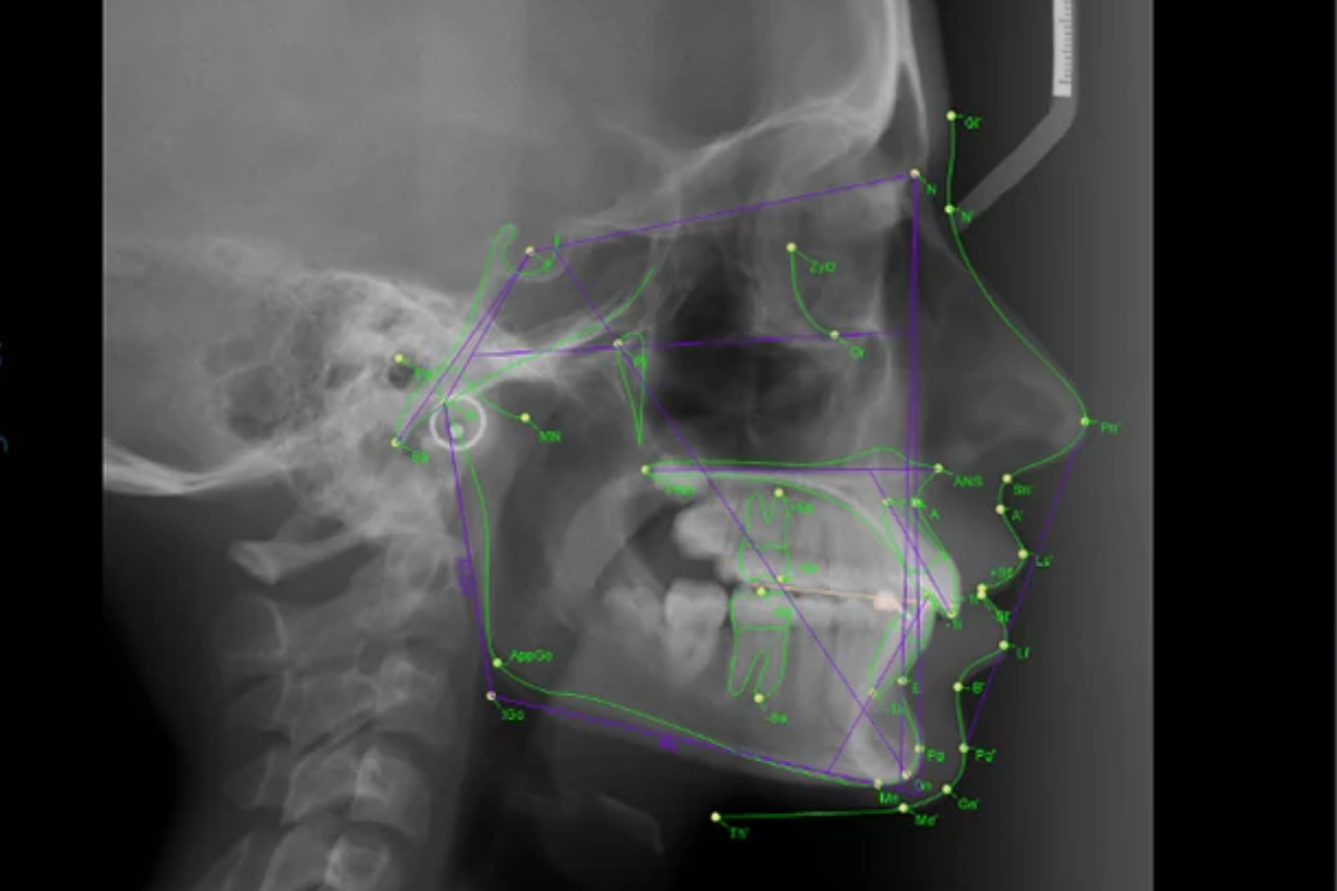 Detalle CBCT (referencial)