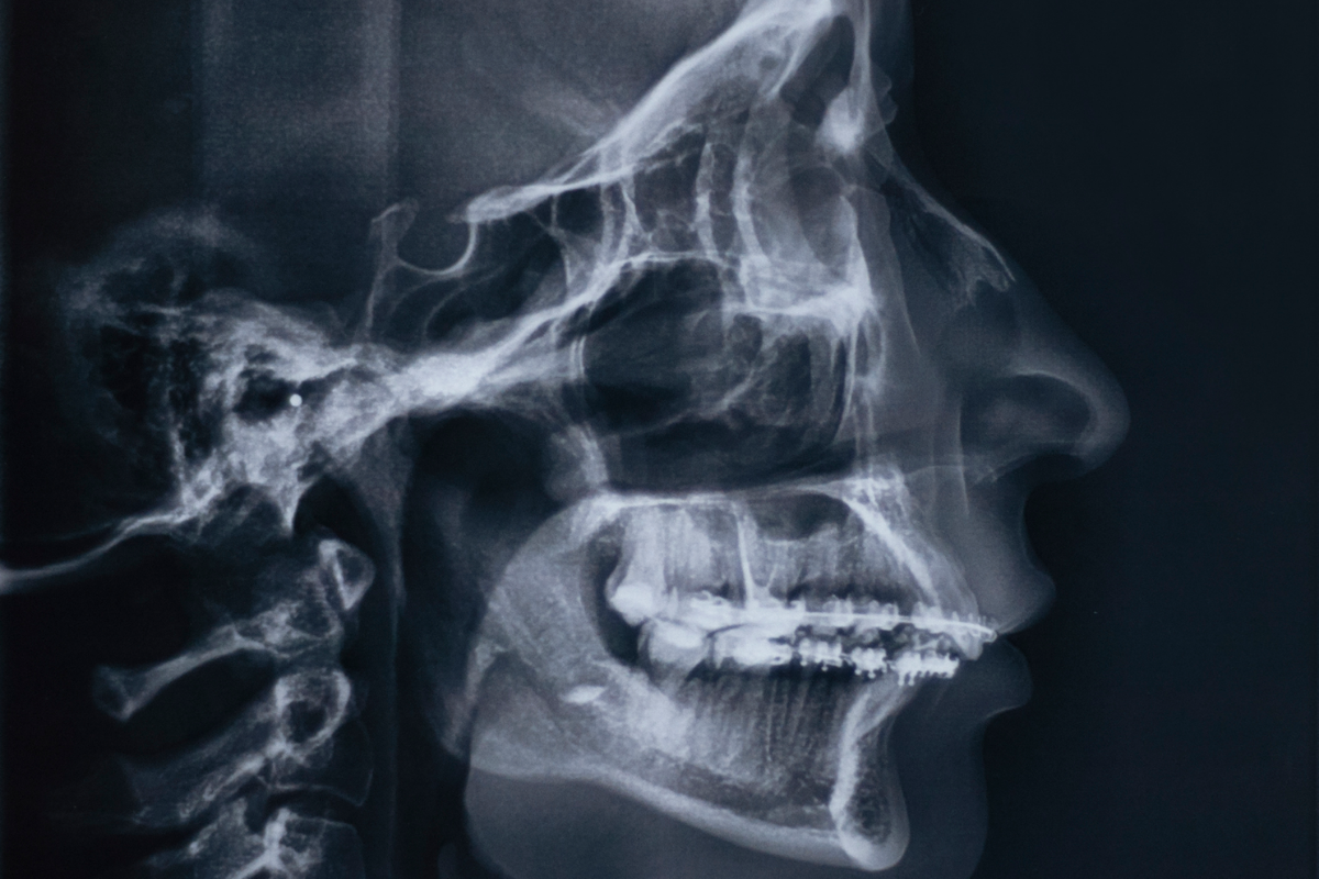 Cabina radiología dental (referencial)