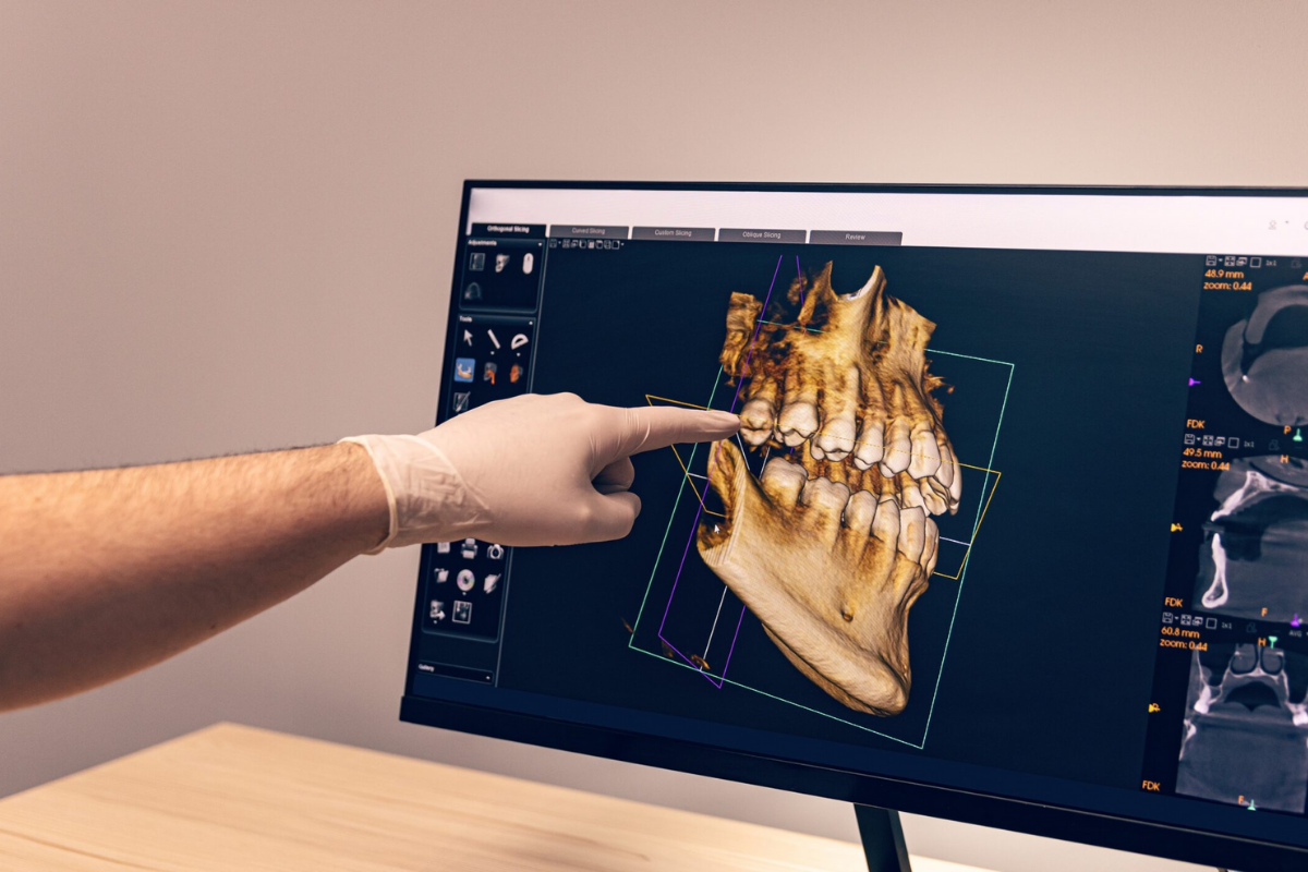 Proceso CBCT (referencial)