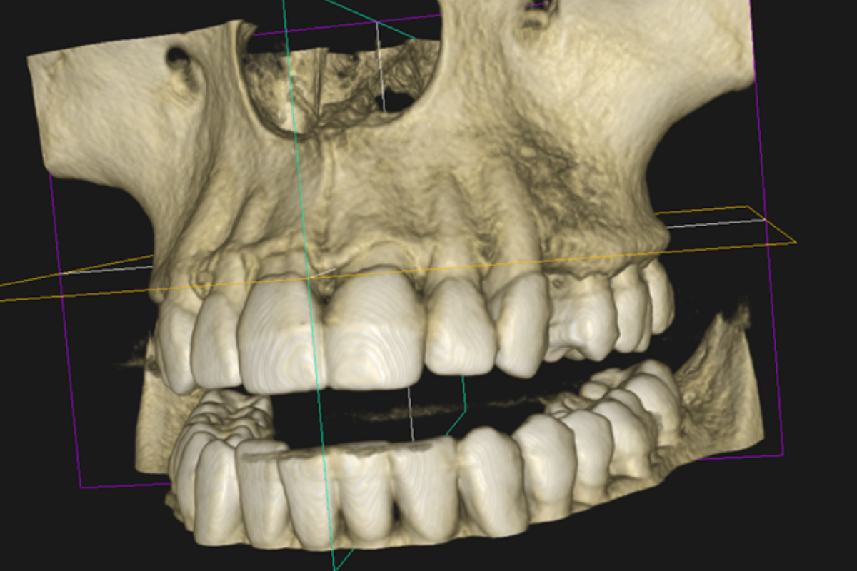 Radiografía panorámica (referencial)