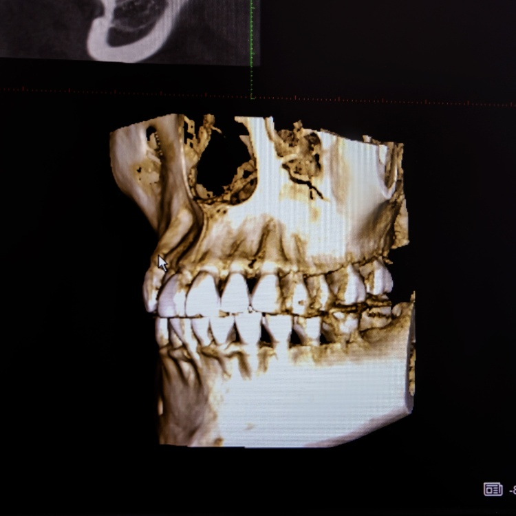 Cefalométrica digital