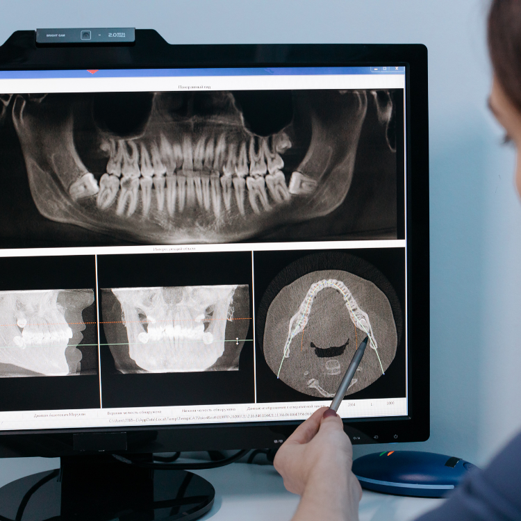 Reconstrucción 3D CBCT