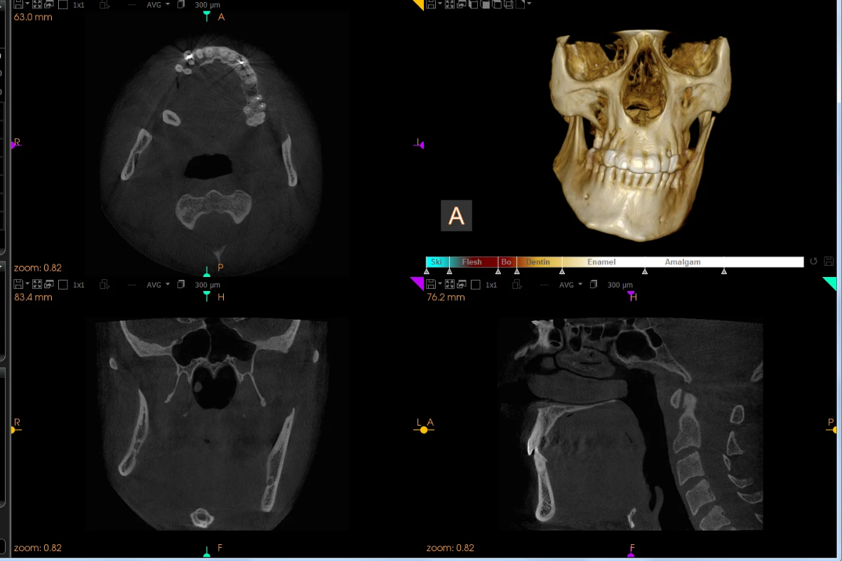 IA en ortodoncia (referencial)