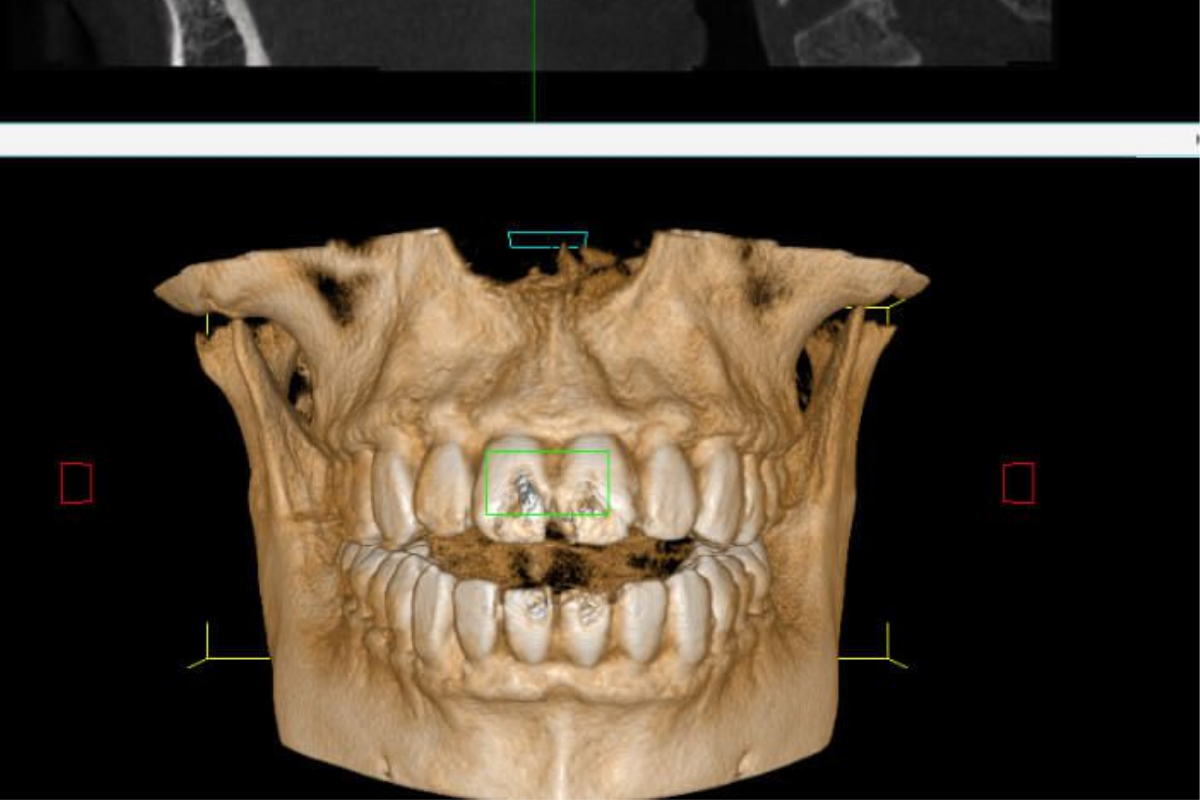 Procesamiento en nube (referencial)