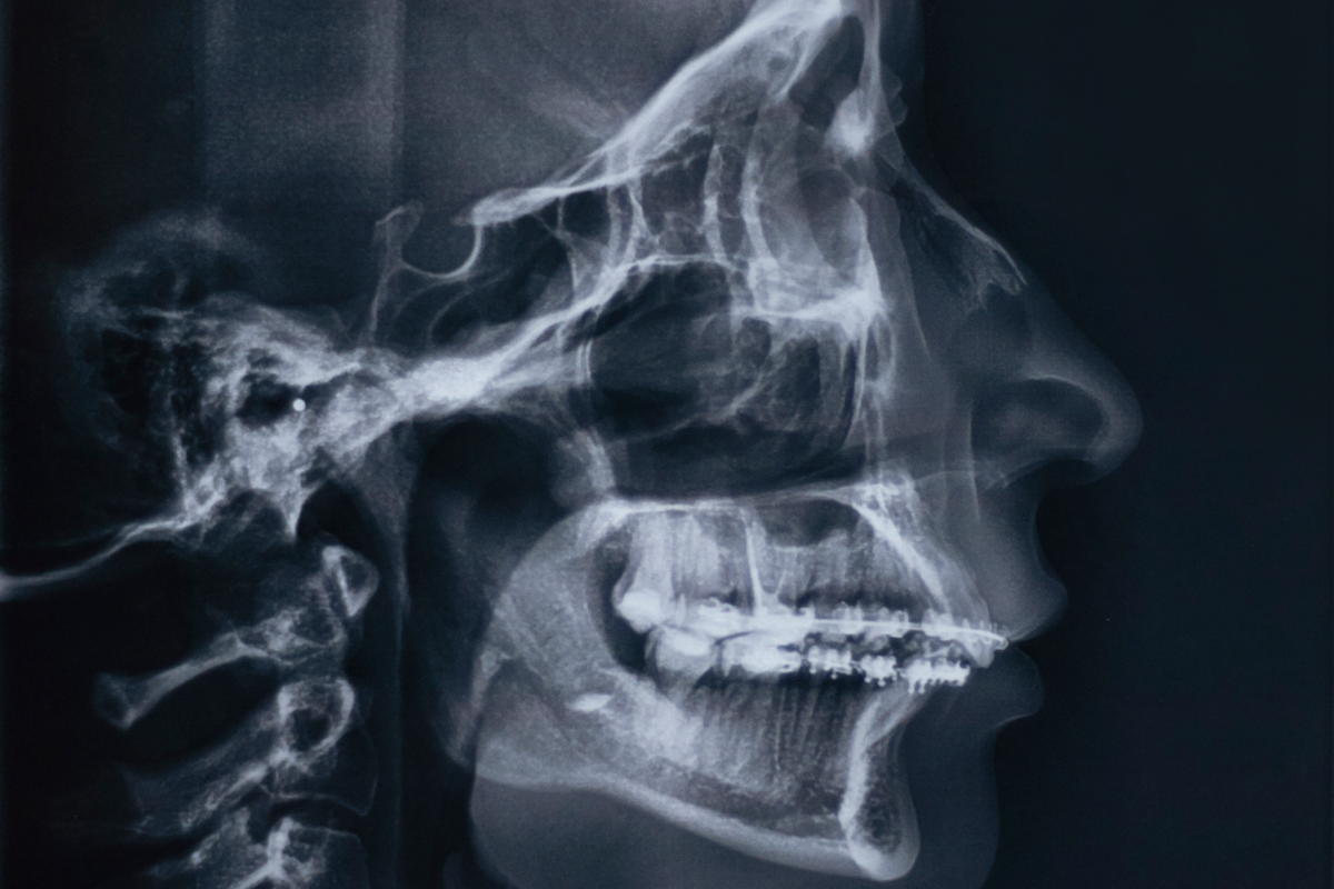 Entrega rápida (referencial)