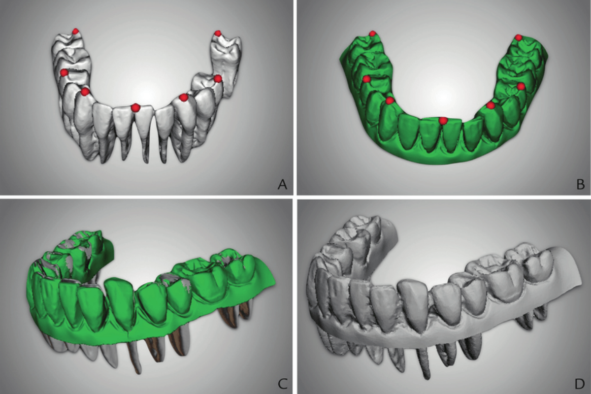 Fusión CBCT + escaneo (referencial)